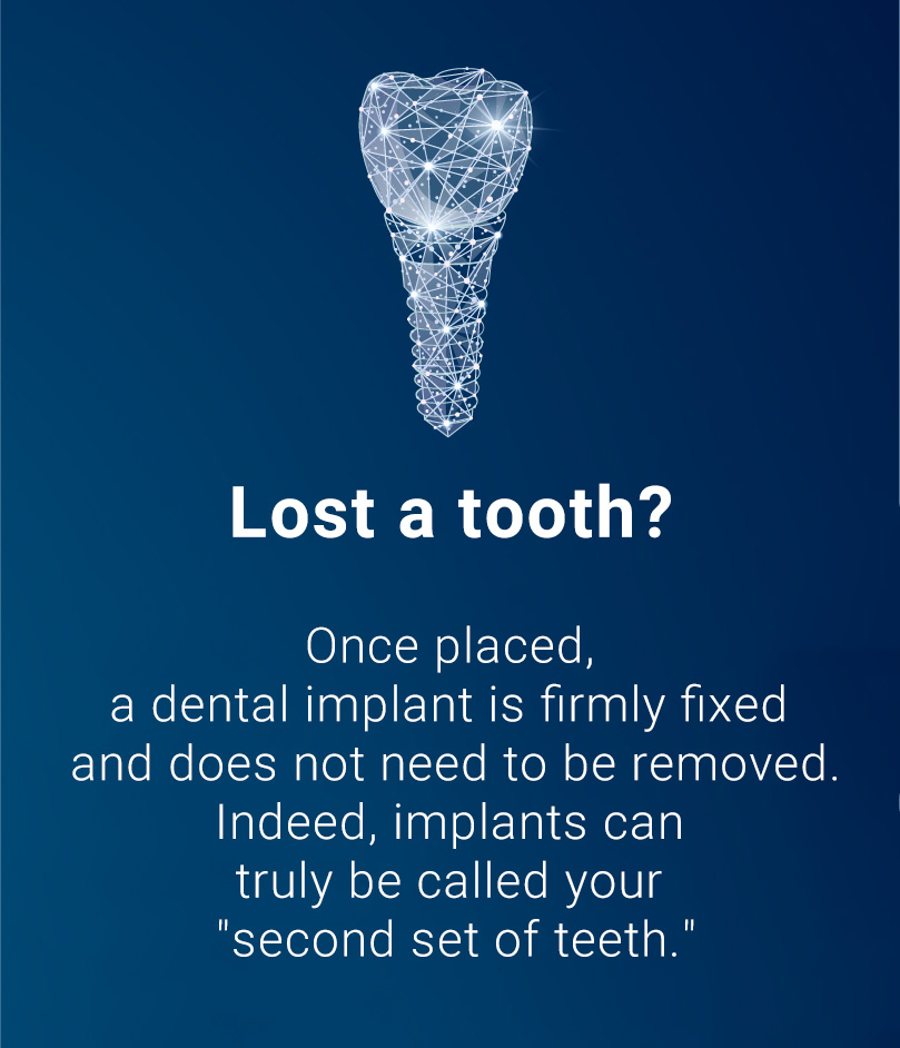 About our Implant Treatment