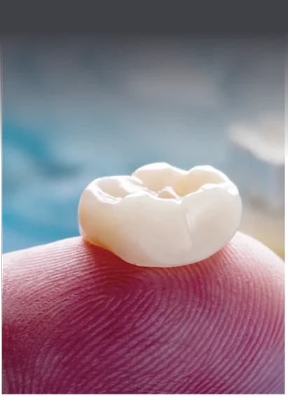 個別に作製されたセラミック補綴物