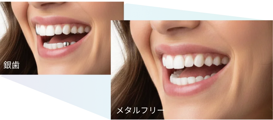 自然な白さを再現した歯